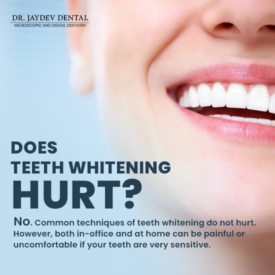 teeth-whitening-treatment-at-best-dental-hospital-in-hyderabad